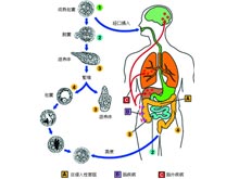 阿米巴肝脓肿