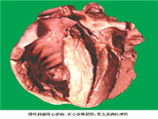 高原性心脏病