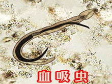 血吸虫病与肝胆疾病
