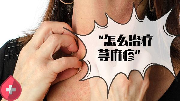 荨麻疹的症状和有效的治疗方法?