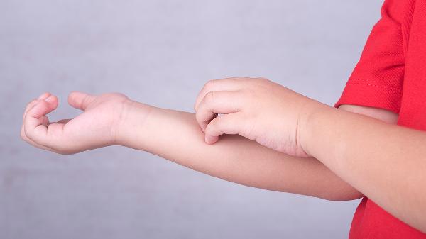 hiv单纯疱疹病毒igm阳性是什么