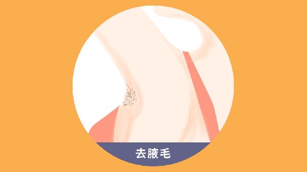 激光脱腋毛可以永久去除吗