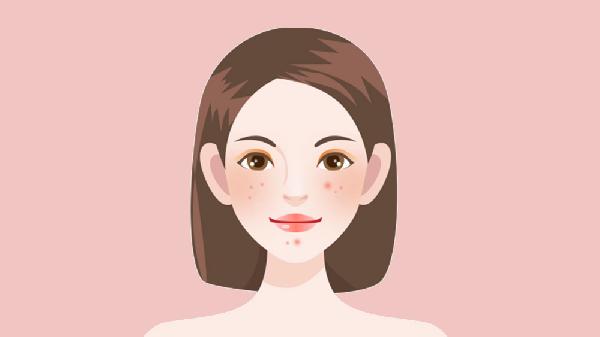 家庭快速祛痘小妙招有哪些