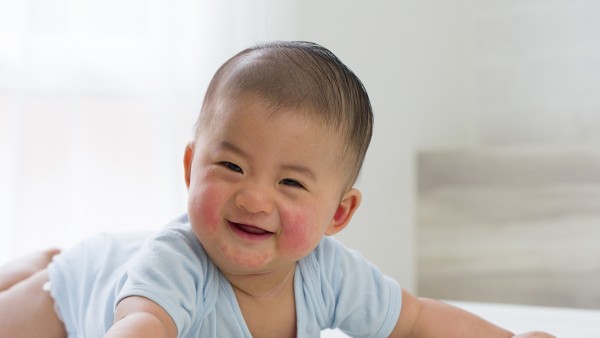 怎么确定是不是湿疹  长湿疹用什么药膏