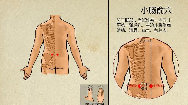 腹针疗法治疗软组织损伤的优点