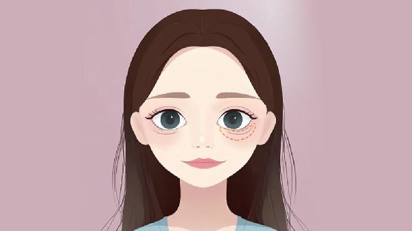 自体脂肪丰卧蚕修复多少钱