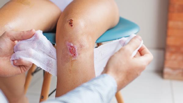 大腿抽脂有什么危害 大腿抽脂暗藏两个危害