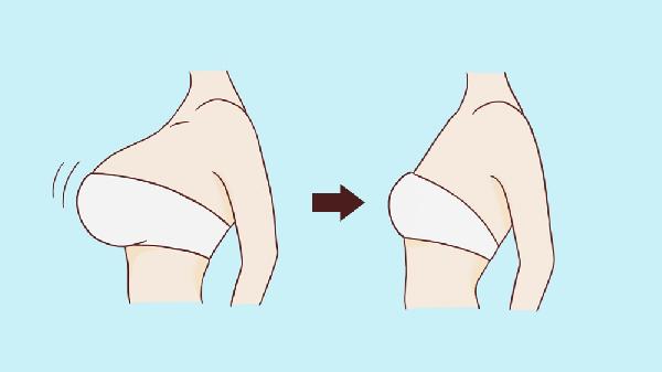 巨乳缩小不适用人群有哪些？